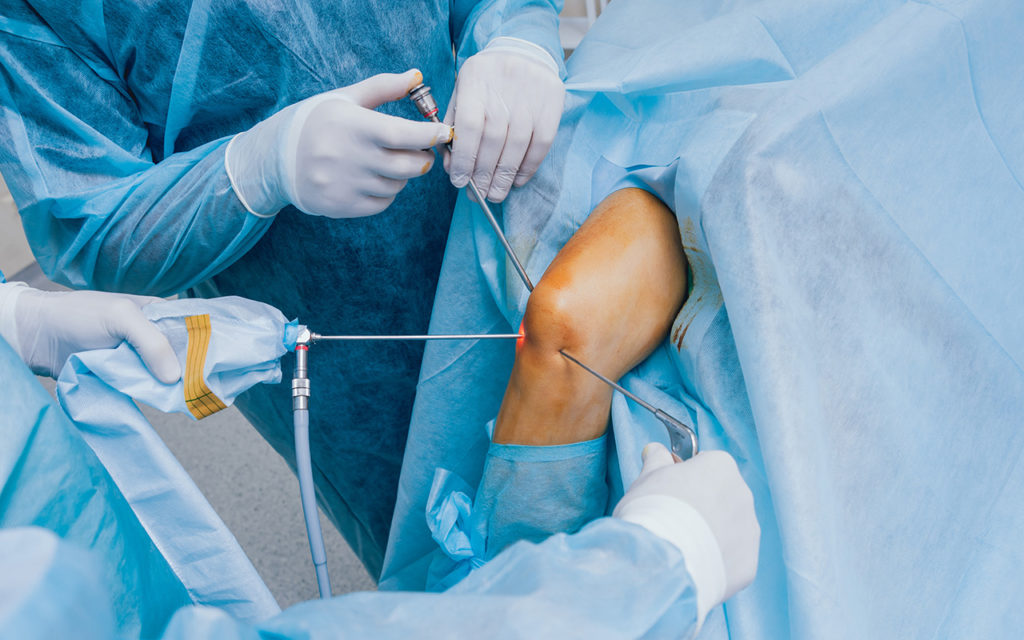 arthroscopic knee procedure