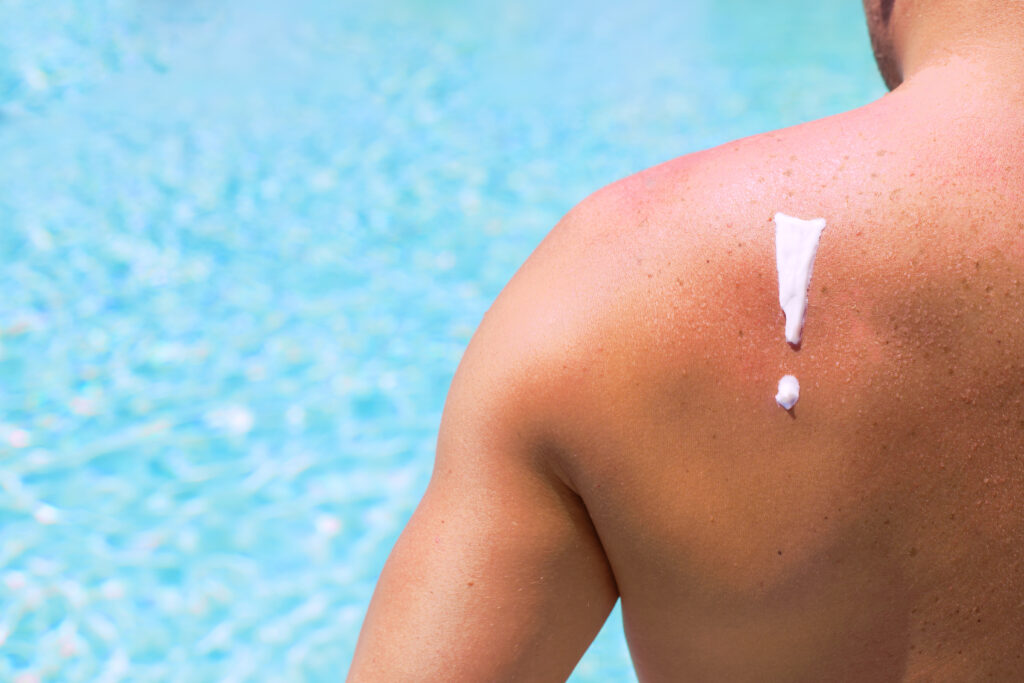 how-long-does-it-take-for-skin-to-repair-after-sun-exposure-insight