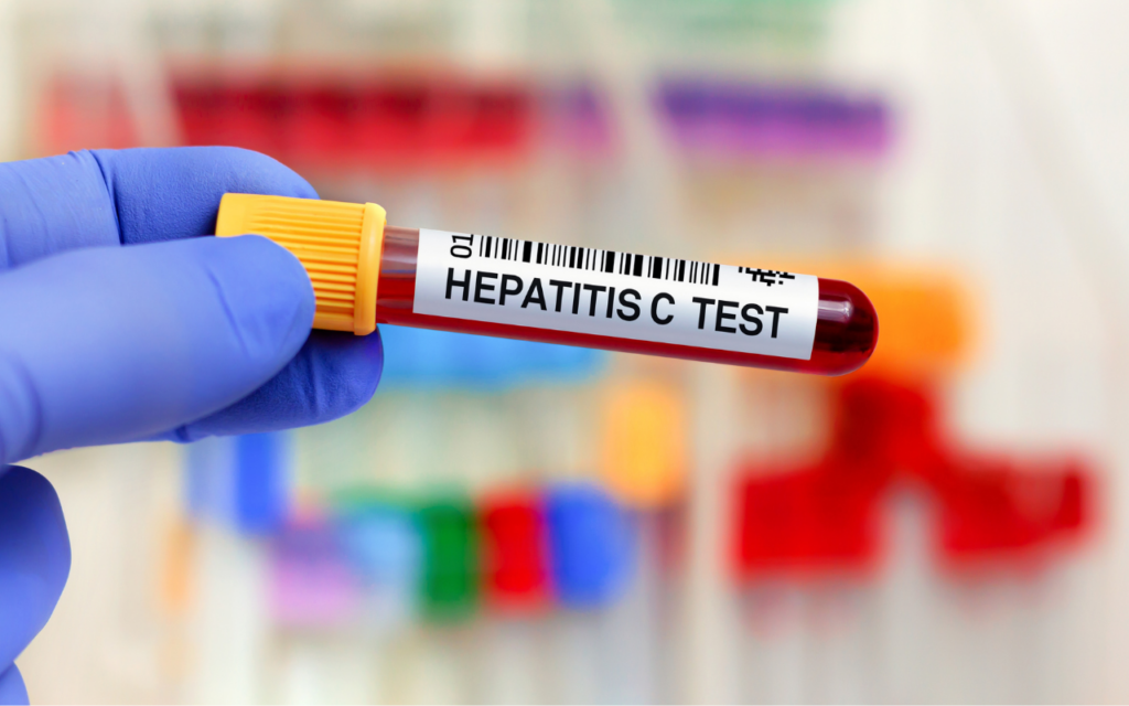 Tackling Treatment Hesitancy In People With Hepatitis C | InSight+