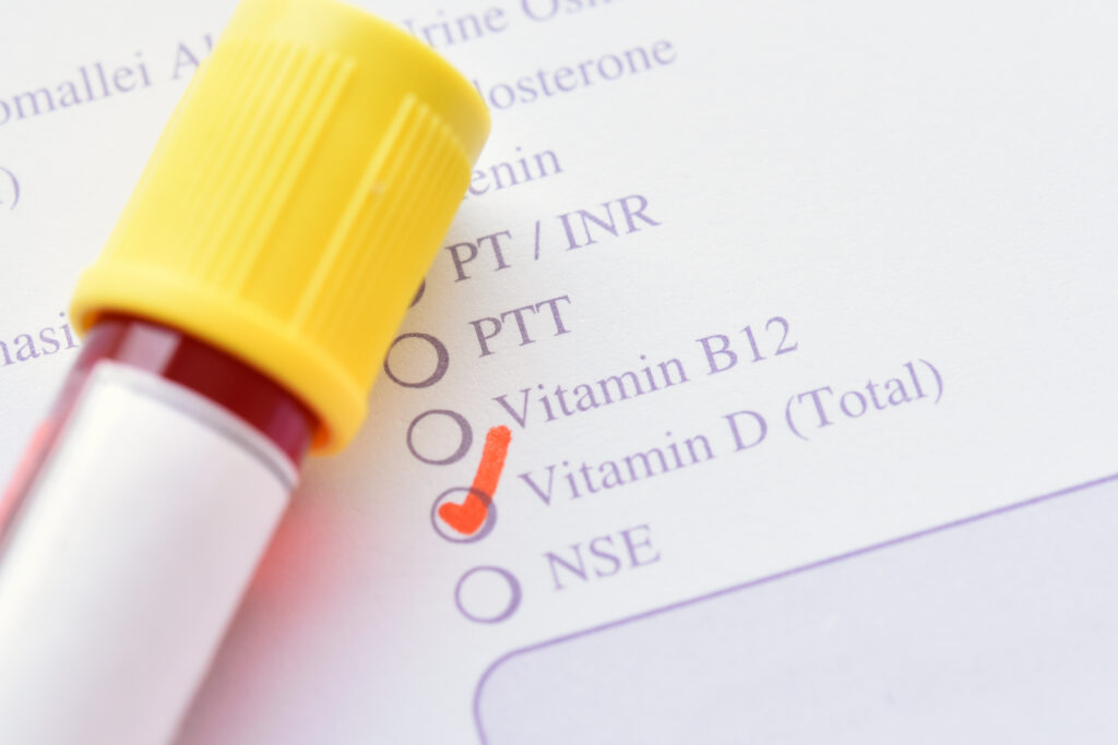 GPs urged not to routinely test children for vitamin D - Featured Image