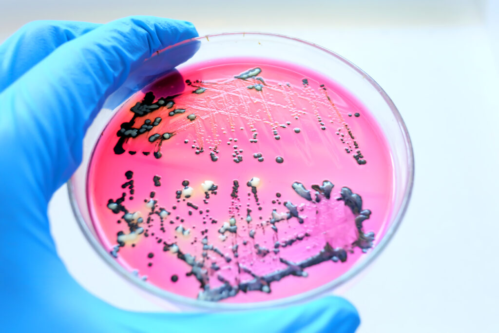 the looming threat of antibiotic-resistant bacteria in Australia - Featured Image