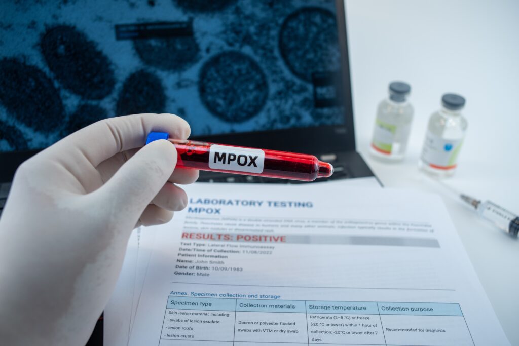 Mpox - to be completed - Featured Image