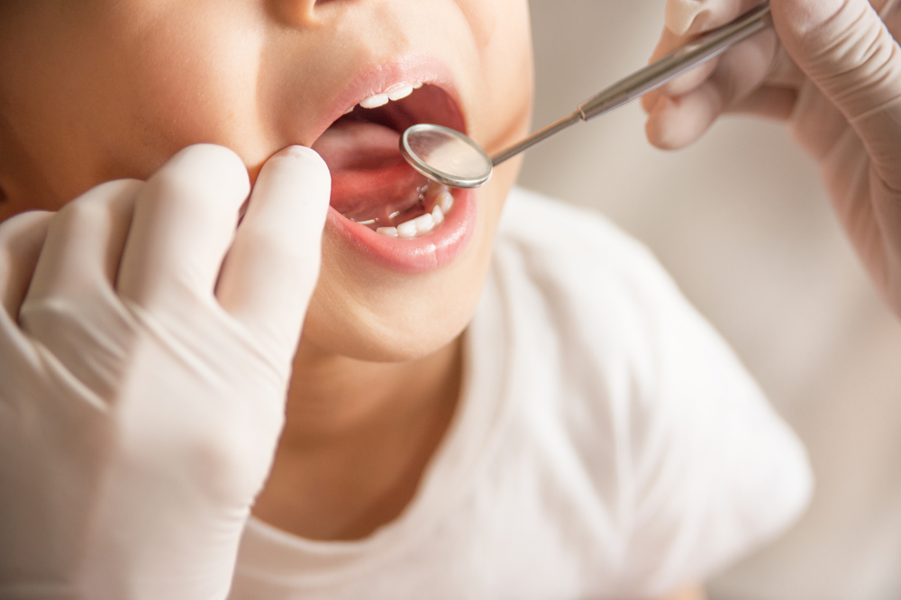 Too many Australians 'missing out' on vital dental care - Featured Image