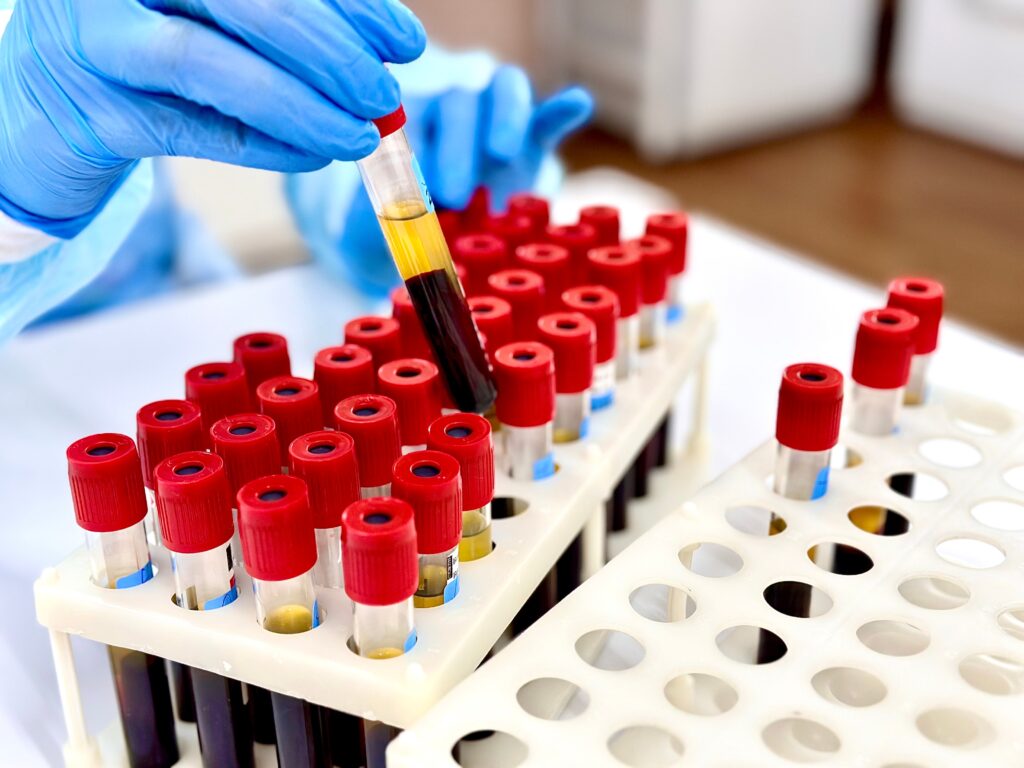 Diagnosing and managing bleeding disorders in regional and remote Australia - Featured Image